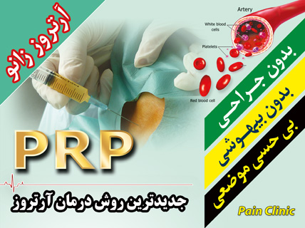 جدیدترین روش درمان آرتروز